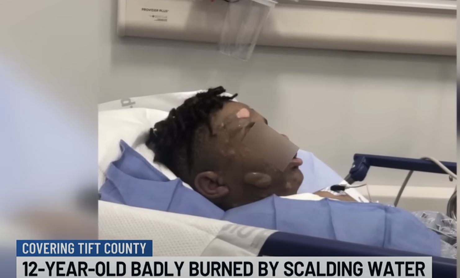 Georgia boy severely burned after friend threw boiling water on him during sleepover 'prank' (Video)