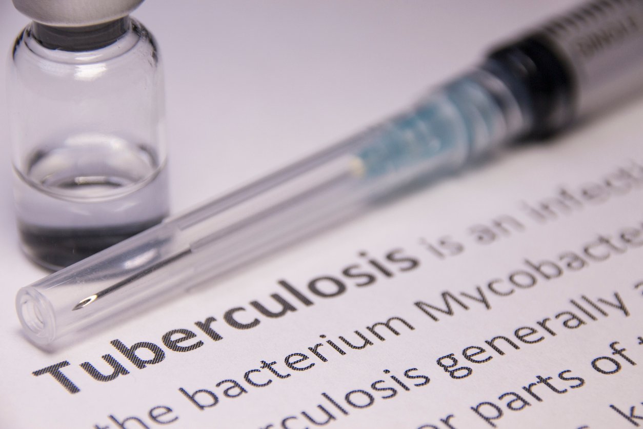 The outbreak of the Kansas tuberculosis is the largest in American history, infected with more than 140 people