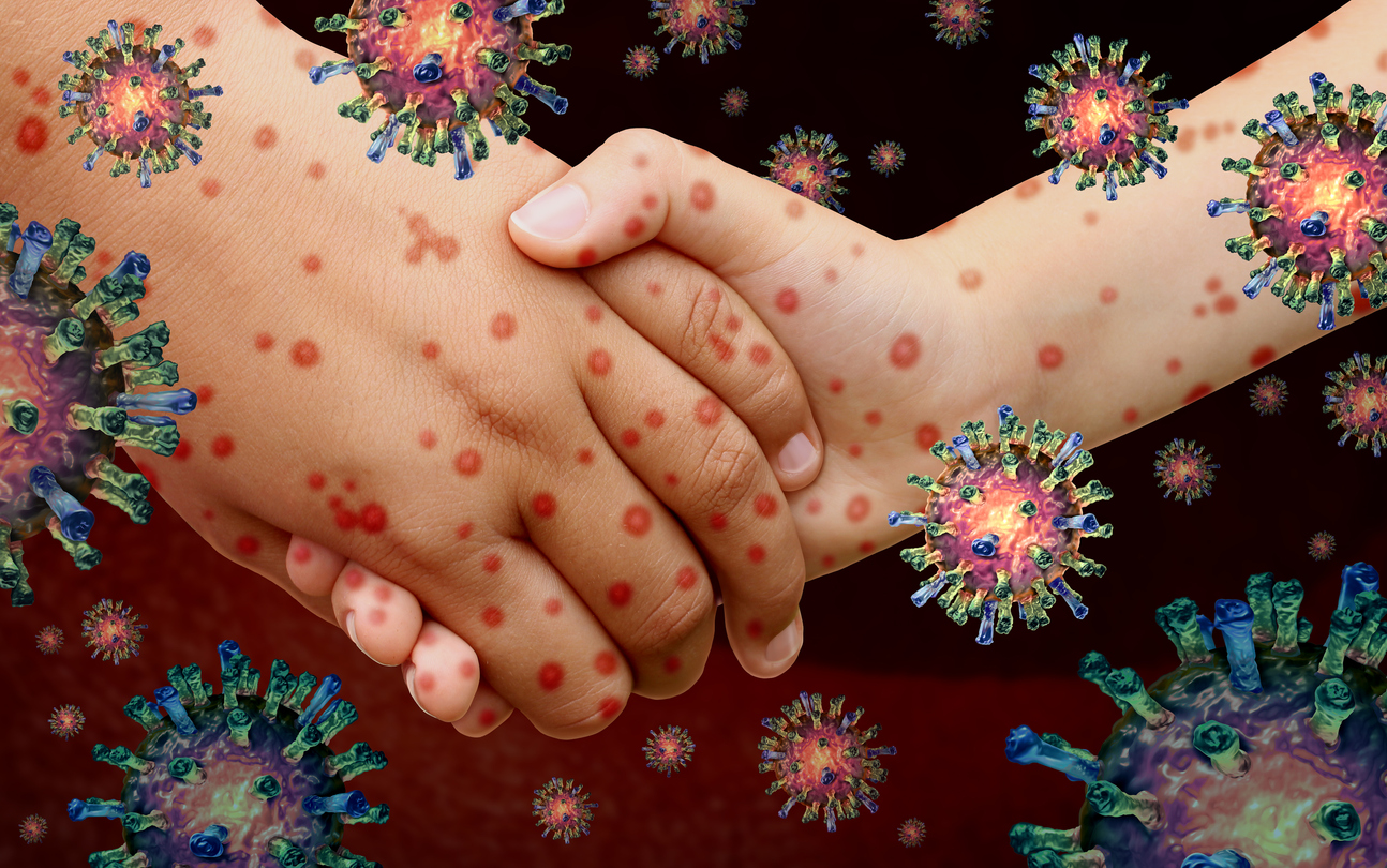 Texas mom said “measles is not bad” because she lost her 6-year-old daughter.